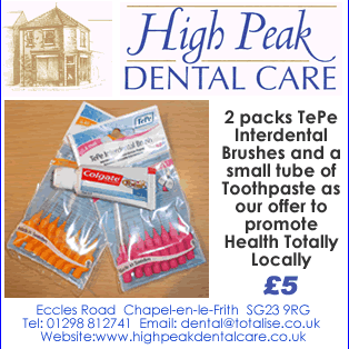 High Peak Dental Offer